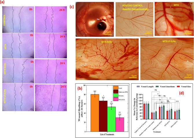 https://cdn.ncbi.nlm.nih.gov/pmc/blobs/8ed2/12214825/f216f5efb2ac/41598_2025_8089_Fig12_HTML.jpg