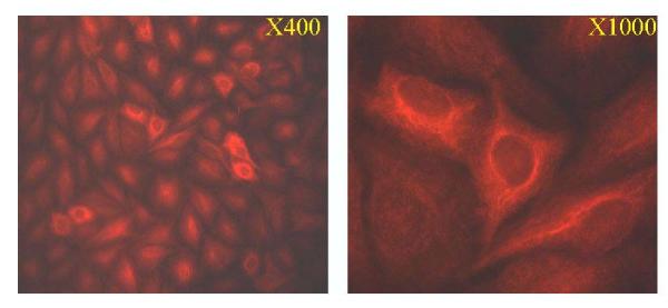 https://cdn.ncbi.nlm.nih.gov/pmc/blobs/8ed4/149413/45616d720852/1476-4598-2-1-6.jpg