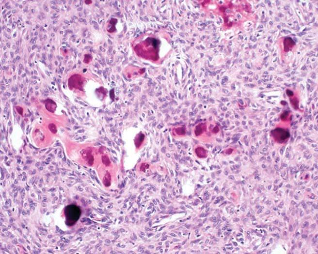 https://cdn.ncbi.nlm.nih.gov/pmc/blobs/8ed4/5380450/251d61376eab/arh0041601900001.jpg