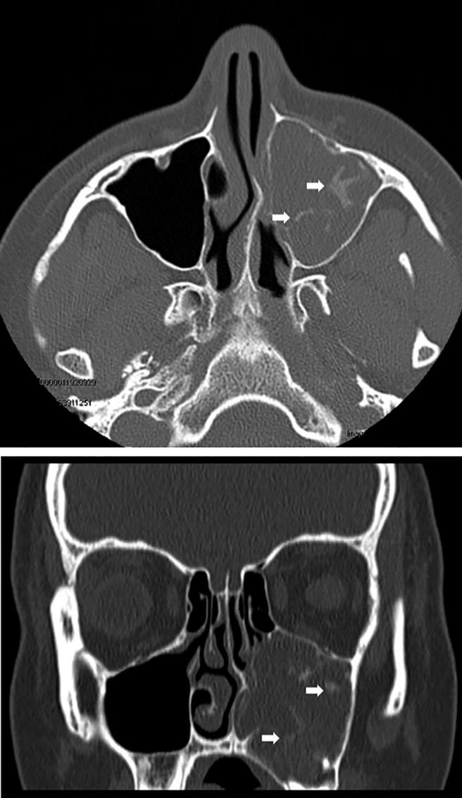 https://cdn.ncbi.nlm.nih.gov/pmc/blobs/8ed4/5380450/f5d92bb97a47/arh0041601900002.jpg