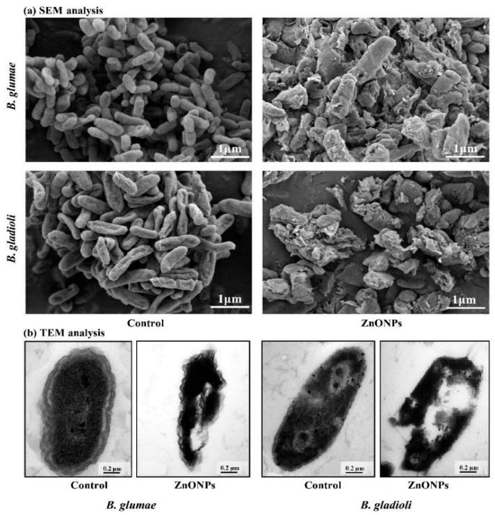 https://cdn.ncbi.nlm.nih.gov/pmc/blobs/8ed9/10675506/51457e3b7eb8/pharmaceutics-15-02634-g007.jpg