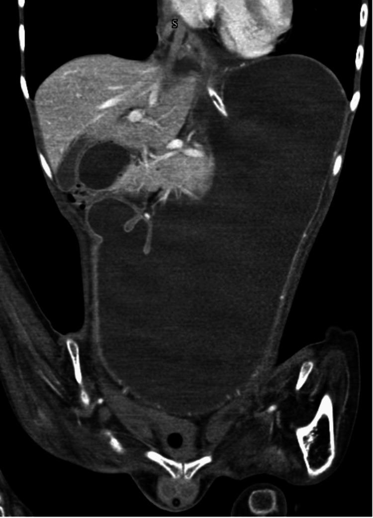 https://cdn.ncbi.nlm.nih.gov/pmc/blobs/8ede/12038874/38c048f49307/cureus-0017-00000081440-i02.jpg