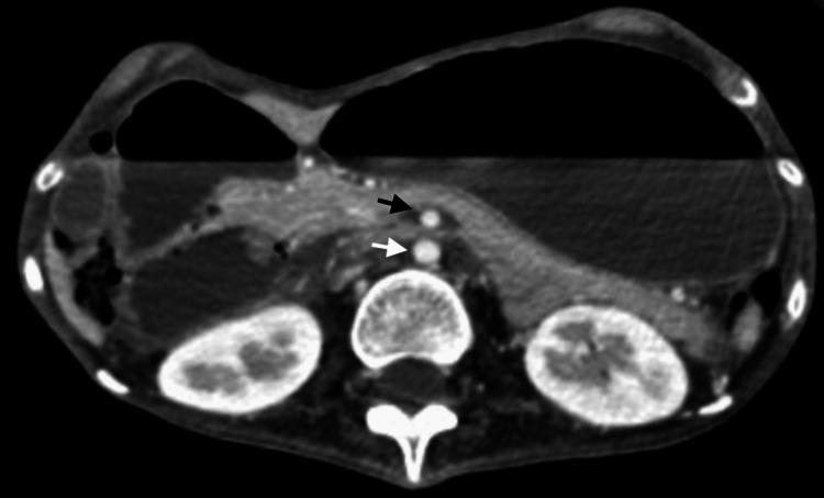 https://cdn.ncbi.nlm.nih.gov/pmc/blobs/8ede/12038874/5687de8abb6c/cureus-0017-00000081440-i01.jpg