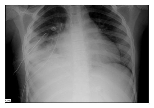 https://cdn.ncbi.nlm.nih.gov/pmc/blobs/8ede/3590555/5142047b10e0/CRIM.PEDIATRICS2013-727824.001.jpg