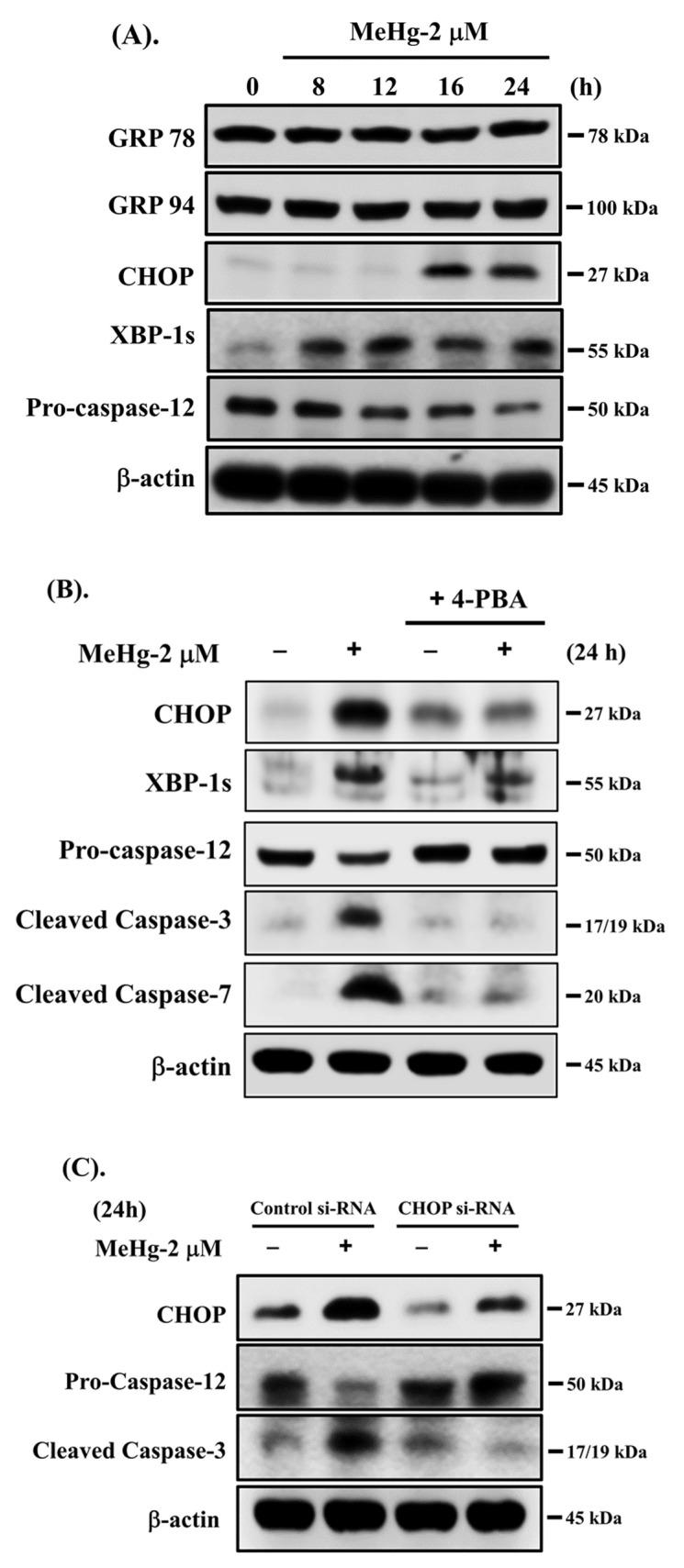 https://cdn.ncbi.nlm.nih.gov/pmc/blobs/8ede/8910963/9f224685af73/ijms-23-02858-g003a.jpg