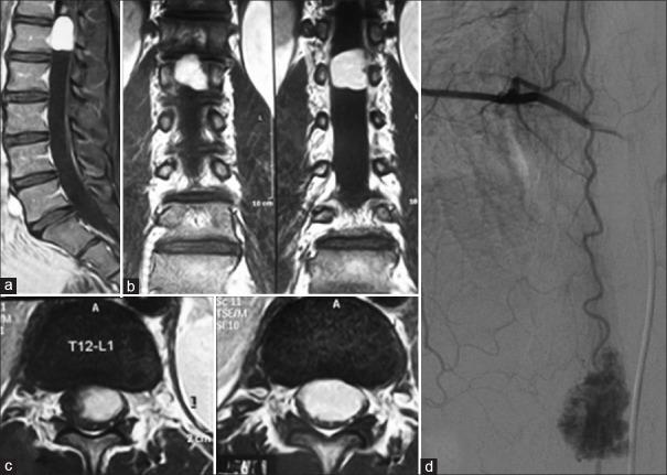 https://cdn.ncbi.nlm.nih.gov/pmc/blobs/8ee1/5532950/7d456a8a35da/AJNS-12-556-g001.jpg