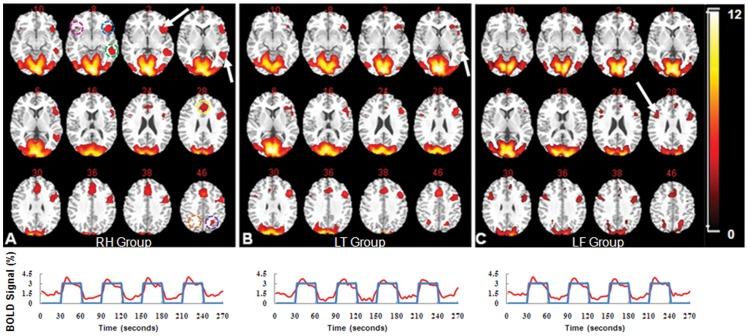 https://cdn.ncbi.nlm.nih.gov/pmc/blobs/8ee3/3608667/8138f4eaf567/pone.0059657.g001.jpg