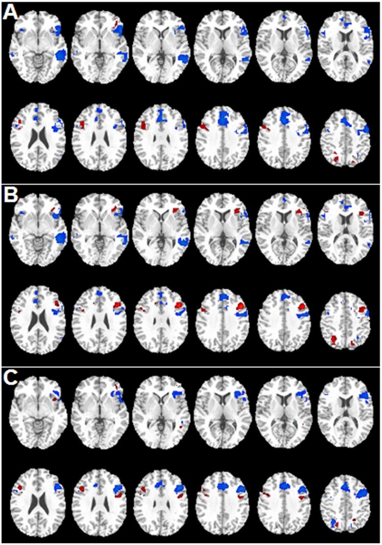 https://cdn.ncbi.nlm.nih.gov/pmc/blobs/8ee3/3608667/bf14f1507322/pone.0059657.g002.jpg