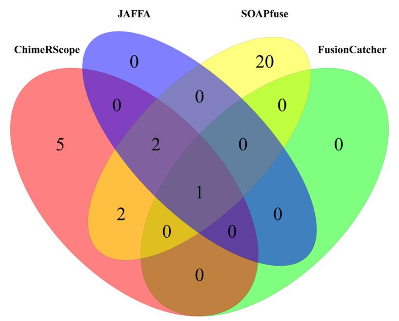 https://cdn.ncbi.nlm.nih.gov/pmc/blobs/8ee4/5737728/61e4e8aa2050/gkx315fig6.jpg