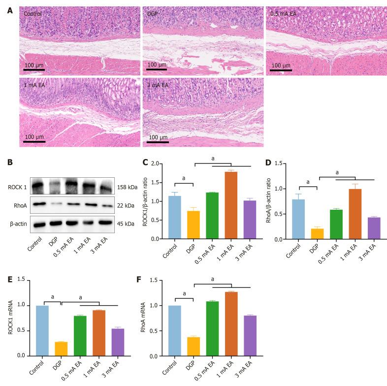https://cdn.ncbi.nlm.nih.gov/pmc/blobs/8ee5/12362441/8086797f05ca/wjd-16-8-107779-g007.jpg