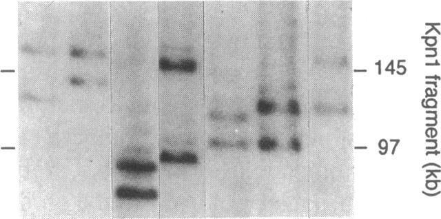 https://cdn.ncbi.nlm.nih.gov/pmc/blobs/8eef/294162/361b82ab6872/jcinvest00033-0146-b.jpg