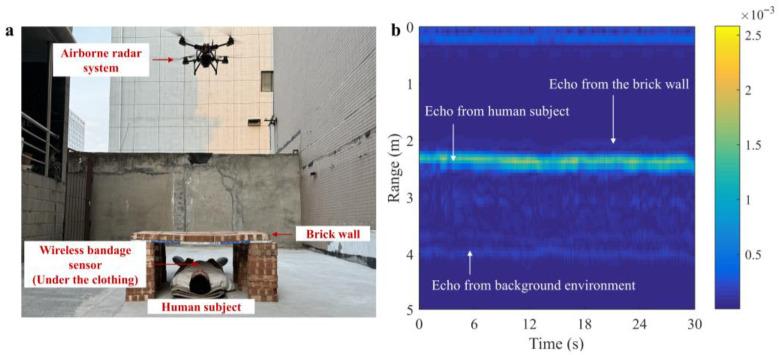 https://cdn.ncbi.nlm.nih.gov/pmc/blobs/8ef1/12431357/95e6b36fa878/sensors-25-05232-g019.jpg
