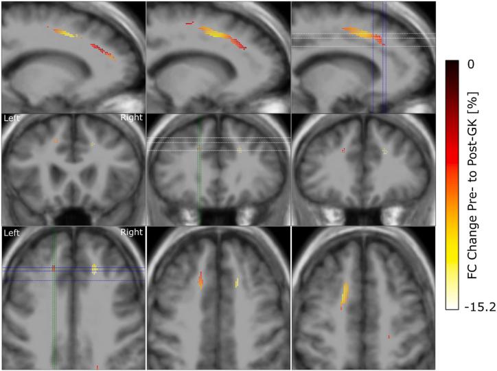 https://cdn.ncbi.nlm.nih.gov/pmc/blobs/8ef7/11325066/45b156a96187/gr4.jpg