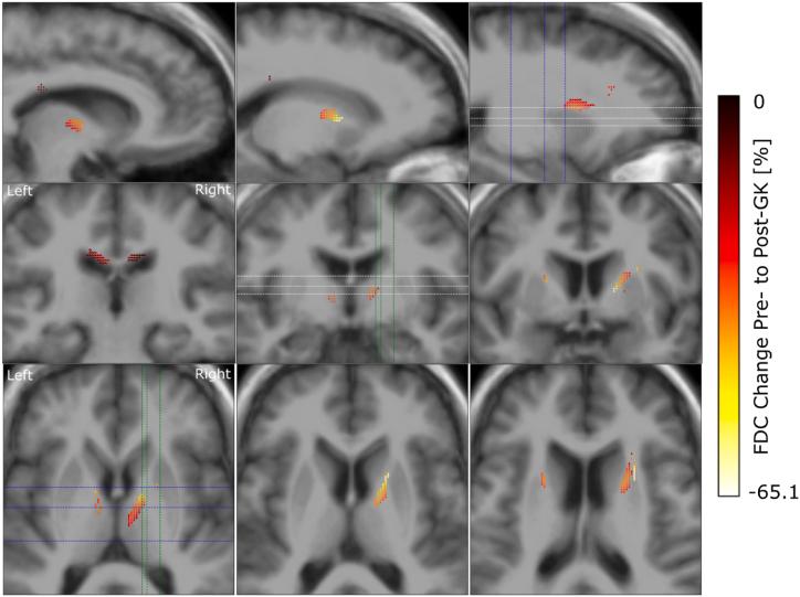 https://cdn.ncbi.nlm.nih.gov/pmc/blobs/8ef7/11325066/e424ac45b765/gr5.jpg