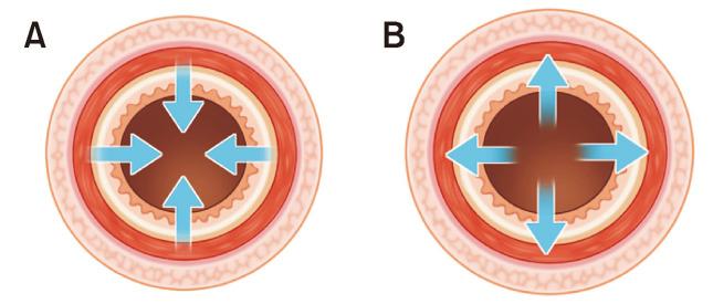 https://cdn.ncbi.nlm.nih.gov/pmc/blobs/8efa/12241913/654c54f8290f/jnm-31-3-304-f1.jpg