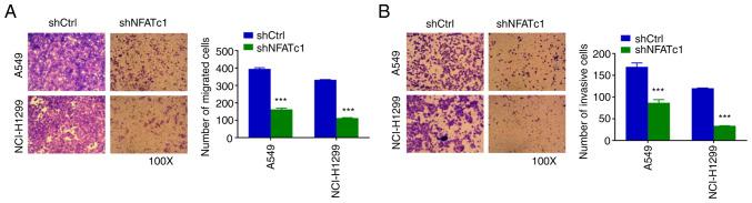 https://cdn.ncbi.nlm.nih.gov/pmc/blobs/8efa/9780516/1c542ea82b15/etm-25-01-11748-g02.jpg