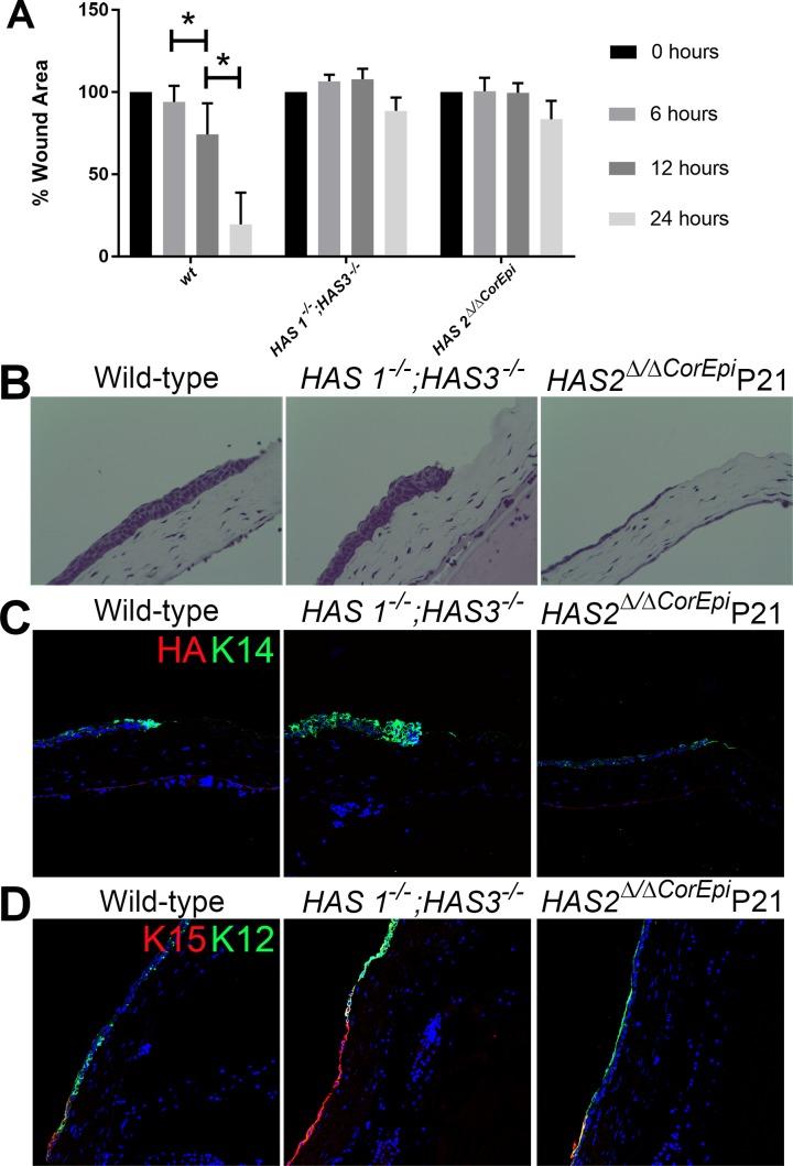 https://cdn.ncbi.nlm.nih.gov/pmc/blobs/8eff/5584473/774b0322cf1b/i1552-5783-58-11-4407-f09.jpg