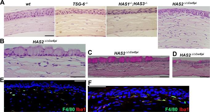 https://cdn.ncbi.nlm.nih.gov/pmc/blobs/8eff/5584473/9bb40d533d1b/i1552-5783-58-11-4407-f04.jpg