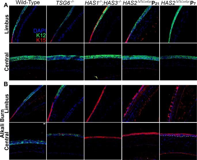 https://cdn.ncbi.nlm.nih.gov/pmc/blobs/8eff/5584473/ff88f3f8740a/i1552-5783-58-11-4407-f08.jpg