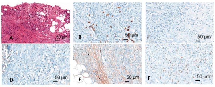 https://cdn.ncbi.nlm.nih.gov/pmc/blobs/8eff/7084265/4e21b5a6b0de/ijms-21-01779-g002.jpg