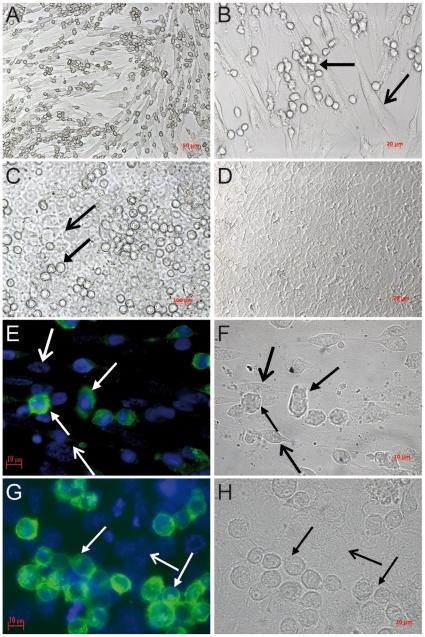 https://cdn.ncbi.nlm.nih.gov/pmc/blobs/8f01/3008683/6ee682749a4c/pone.0014409.g001.jpg