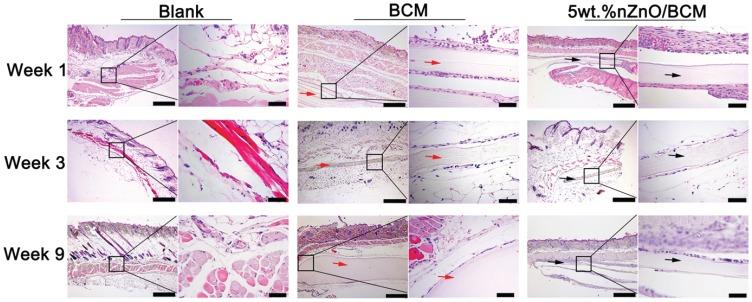 https://cdn.ncbi.nlm.nih.gov/pmc/blobs/8f03/6954087/8d50dda43b8b/IJN-15-1-g0005.jpg
