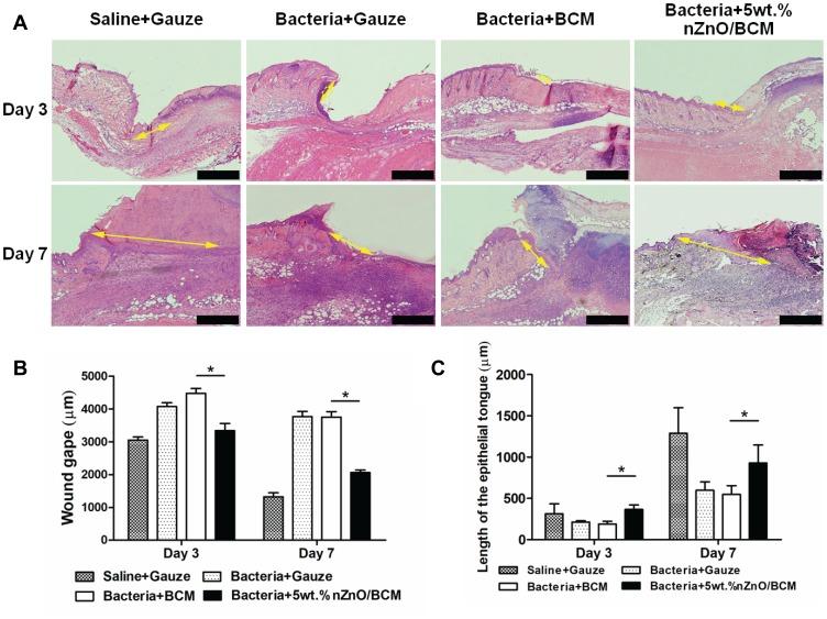 https://cdn.ncbi.nlm.nih.gov/pmc/blobs/8f03/6954087/f17f2cd9f644/IJN-15-1-g0008.jpg