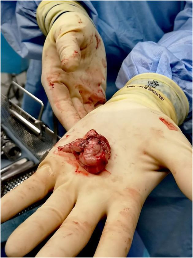 https://cdn.ncbi.nlm.nih.gov/pmc/blobs/8f07/7468480/601fa60c2250/fneur-11-00833-g0001.jpg