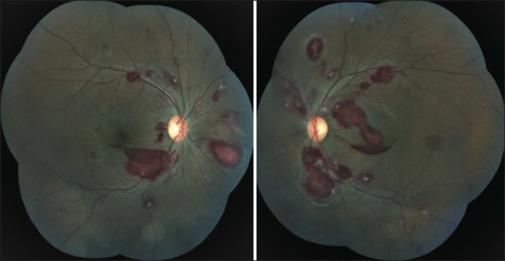 https://cdn.ncbi.nlm.nih.gov/pmc/blobs/8f0c/11834899/f8fc10b6b54d/IJO-73-107-g002.jpg