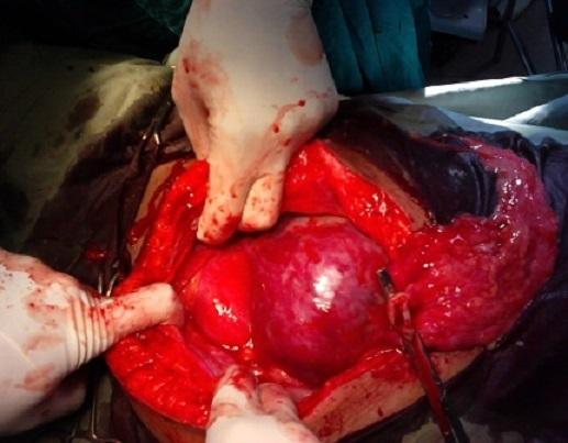 https://cdn.ncbi.nlm.nih.gov/pmc/blobs/8f0f/4236923/a0bebd7f60ef/PAMJ-18-181-g001.jpg