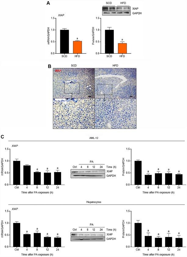 https://cdn.ncbi.nlm.nih.gov/pmc/blobs/8f19/6949096/0f0076f13745/aging-11-102559-g001.jpg