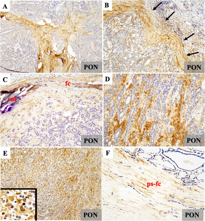 https://cdn.ncbi.nlm.nih.gov/pmc/blobs/8f23/8465710/9f5a58c68c21/13000_2021_1146_Fig2_HTML.jpg