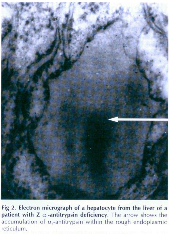 https://cdn.ncbi.nlm.nih.gov/pmc/blobs/8f24/9665556/017ed9e515f4/jrcollphyslond146952-0076-a.jpg