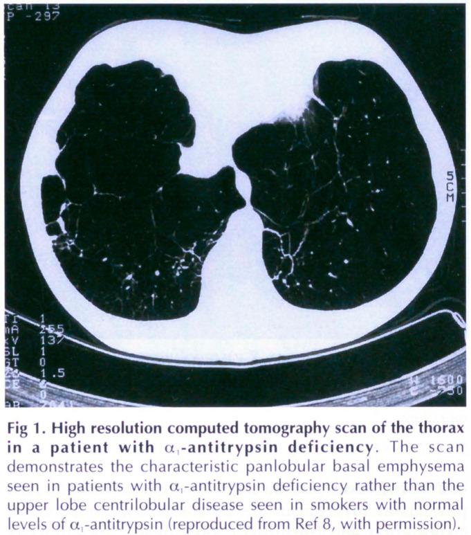 https://cdn.ncbi.nlm.nih.gov/pmc/blobs/8f24/9665556/b75f7651c53d/jrcollphyslond146952-0075-b.jpg