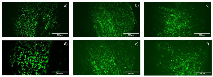 https://cdn.ncbi.nlm.nih.gov/pmc/blobs/8f2b/10222618/5128949aa187/materials-16-03869-g004.jpg