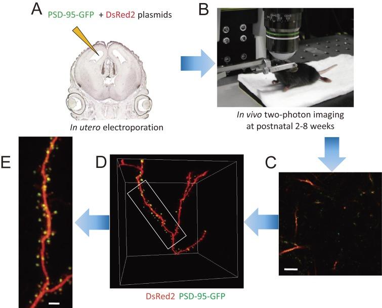 https://cdn.ncbi.nlm.nih.gov/pmc/blobs/8f2d/5713177/e377e408674f/pjab-93-483-g004.jpg