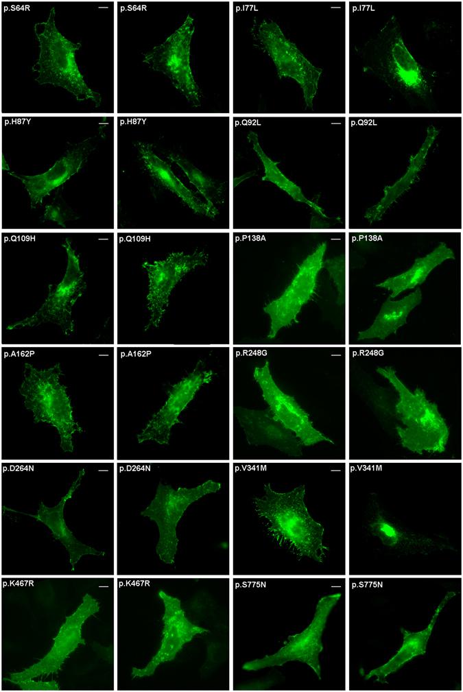 https://cdn.ncbi.nlm.nih.gov/pmc/blobs/8f32/5432510/3e8f6204c2a7/41598_2017_2074_Fig7_HTML.jpg