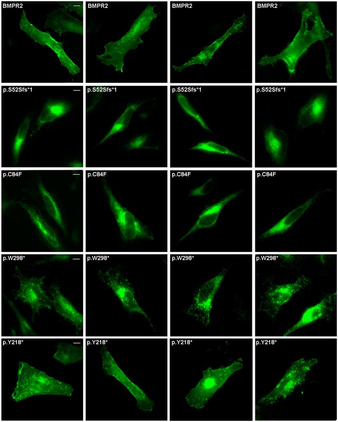 https://cdn.ncbi.nlm.nih.gov/pmc/blobs/8f32/5432510/9bbde69b7c3f/41598_2017_2074_Fig6_HTML.jpg