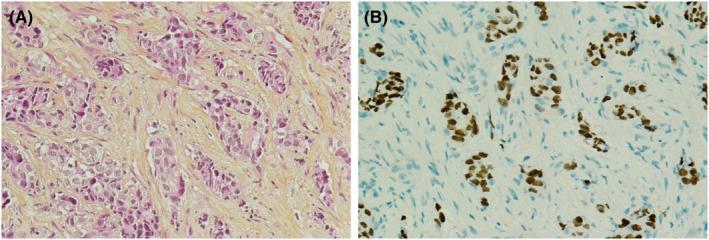 https://cdn.ncbi.nlm.nih.gov/pmc/blobs/8f36/9544831/4e6d8cca9223/CYT-33-633-g001.jpg