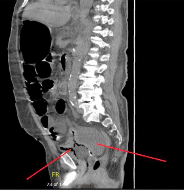 https://cdn.ncbi.nlm.nih.gov/pmc/blobs/8f37/4643468/43c60c7624b2/gr2.jpg