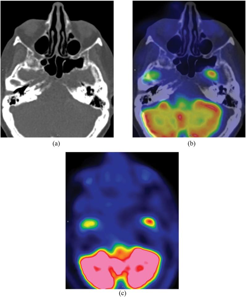 https://cdn.ncbi.nlm.nih.gov/pmc/blobs/8f39/12409854/f6693f0646bb/IOPH_A_2365262_F0006_OC.jpg