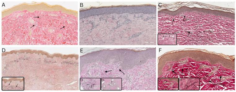 https://cdn.ncbi.nlm.nih.gov/pmc/blobs/8f40/11672911/315c78a1f1c5/bioengineering-11-01270-g006.jpg