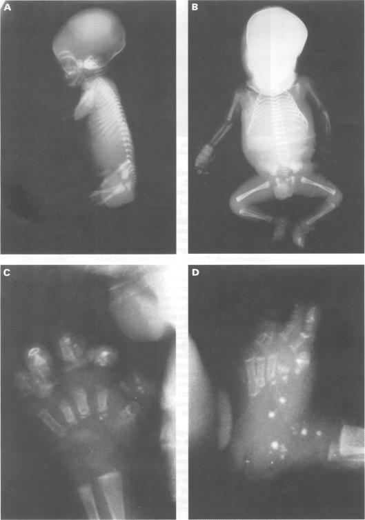 https://cdn.ncbi.nlm.nih.gov/pmc/blobs/8f41/1051401/636ac314f687/jmedgene00237-0075-a.jpg