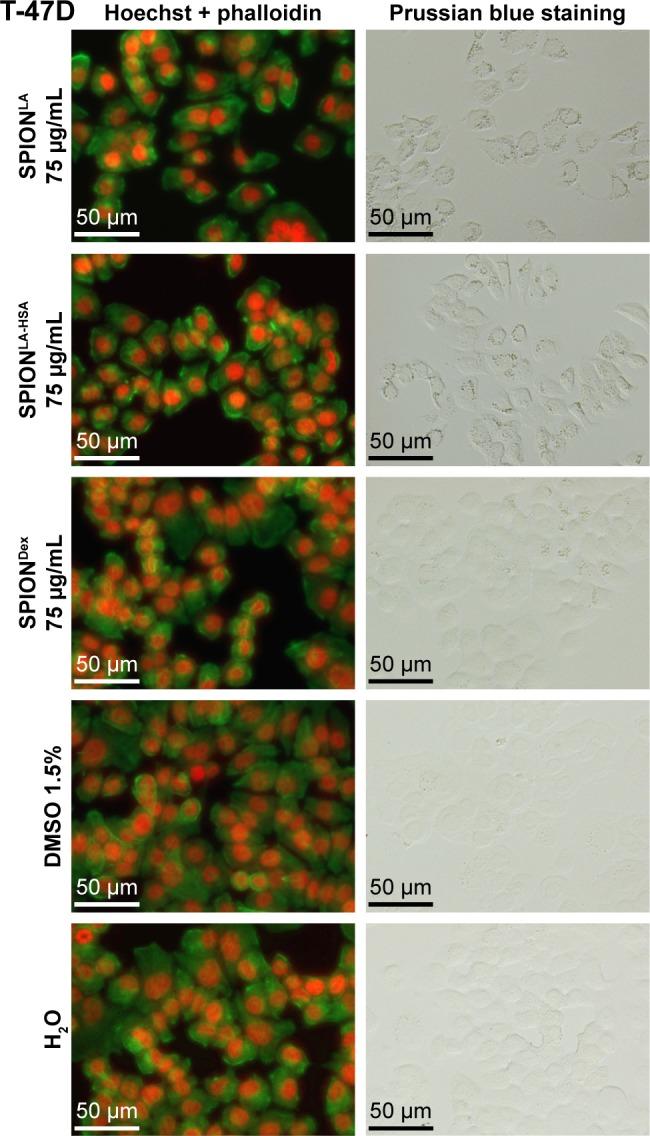 https://cdn.ncbi.nlm.nih.gov/pmc/blobs/8f43/5402883/4cfc8c916431/ijn-12-3207Fig3.jpg