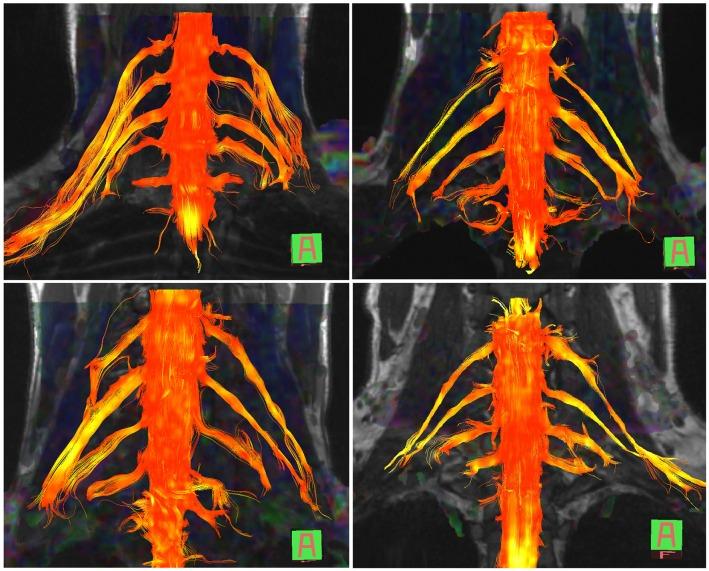 https://cdn.ncbi.nlm.nih.gov/pmc/blobs/8f44/7177010/0970aaf773cf/fsurg-07-00019-g0001.jpg
