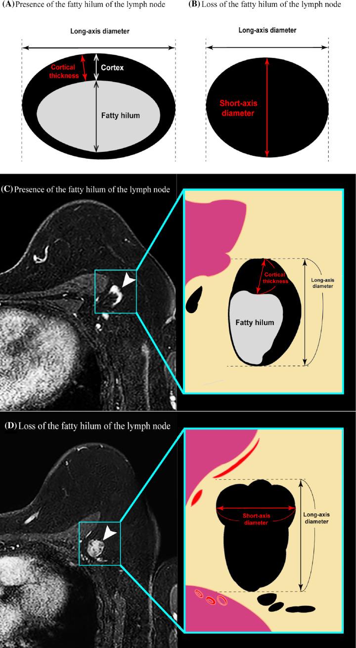 https://cdn.ncbi.nlm.nih.gov/pmc/blobs/8f44/9513385/23d9071b99c5/fonc-12-989650-g002.jpg