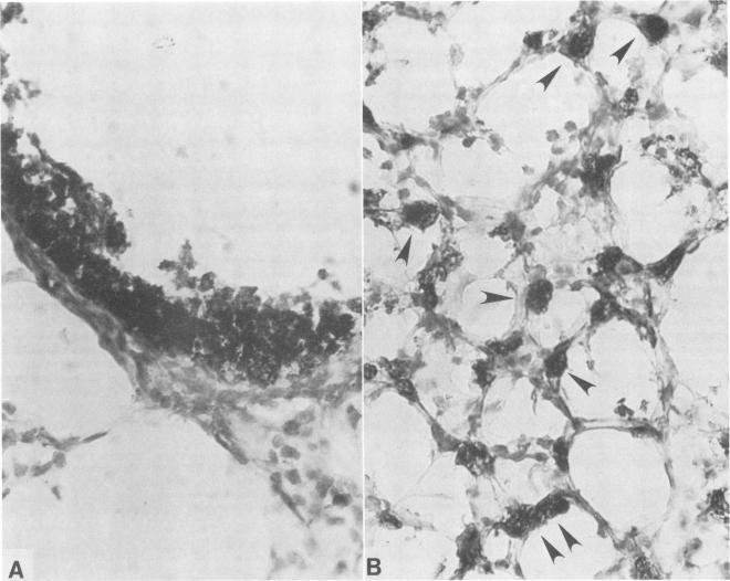 https://cdn.ncbi.nlm.nih.gov/pmc/blobs/8f4b/313571/b54a20160a1c/iai00057-0098-a.jpg