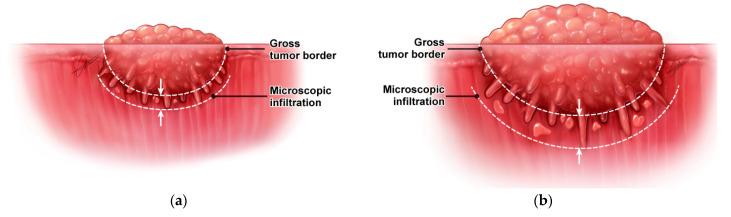 https://cdn.ncbi.nlm.nih.gov/pmc/blobs/8f4d/9688090/e17c208c9b4b/cancers-14-05702-g003.jpg