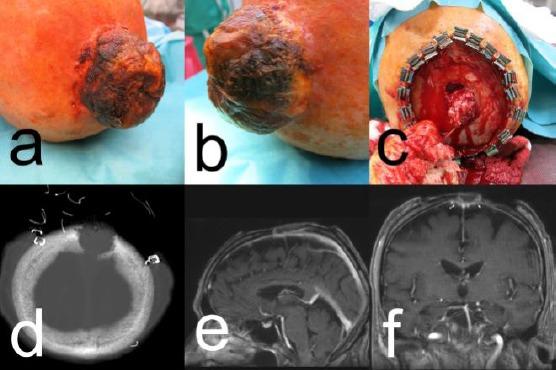 https://cdn.ncbi.nlm.nih.gov/pmc/blobs/8f53/6910817/1953407aa244/OAMJMS-7-3030-g001.jpg