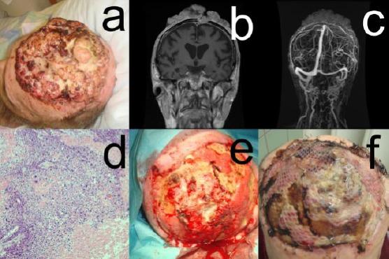 https://cdn.ncbi.nlm.nih.gov/pmc/blobs/8f53/6910817/c020449a8b72/OAMJMS-7-3030-g003.jpg